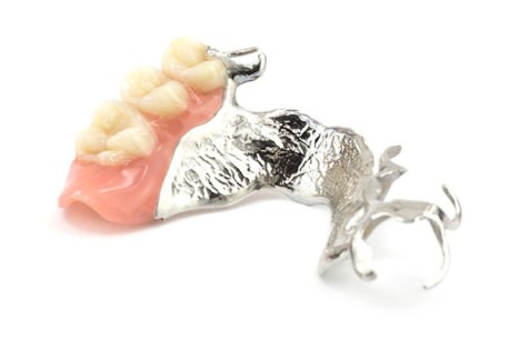 removable partial dentures
